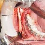 ORal-Surg-7-3-150x150