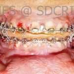 ORal-Surg-7-5-150x150