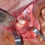 OS-Surg5-3-150x150