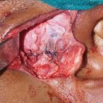 OS-Surg5-6-150x150