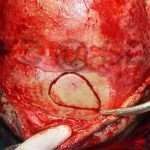Oral-Surg9-3-150x150