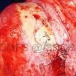 Oral-Surg9-5-150x150