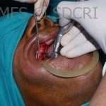 Oralsurg-8-2-150x150 (2)