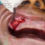 Oralsurg-8-3-150x150 (2)