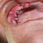 Oralsurg-8-4-150x150 (2)
