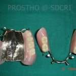 Prostho-Surg1-3-150x150