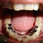 Prostho-Surg1-4-150x150
