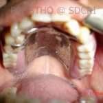 Prostho-Surg1-5-150x150