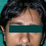 Prostho-Surg2-4-150x150