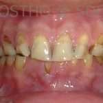 Prostho-surg3-1-150x150