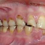 Prostho-surg3-2-150x150