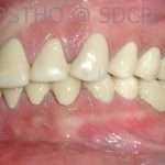 Prostho-surg3-6-150x150