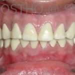 Prostho-surg3-9-150x150