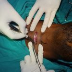 Surgery-2-1-150x150