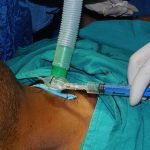 Surgery-2-2-150x150