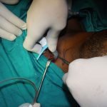 Surgery-2-3-150x150
