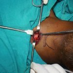 Surgery-2-4-150x150