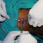 Surgery-2-5-150x150