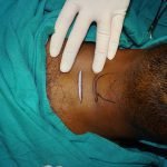Surgery-2-6-150x150