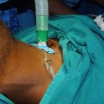 Surgery-2-7-150x150