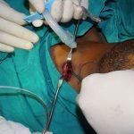 Surgery-2-9-150x150