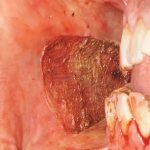 Surgery-3-1-150x150