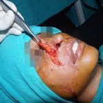 surgery-3-150x150