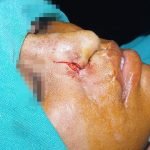 surgery-4-150x150