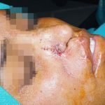 surgery-5-150x150